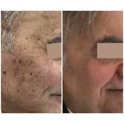 collage_export_FCDF0024-E498-47A2-B9F8-68CEE7EAA201